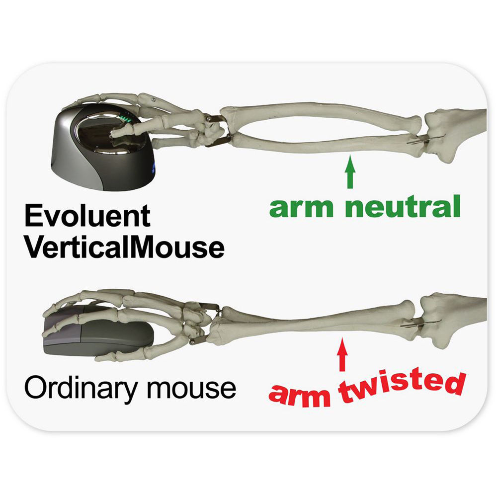 Evoluent VerticalMouse 4 Right Bluetooth ergonomic vertical wireless mouse for right-handed users — view 4