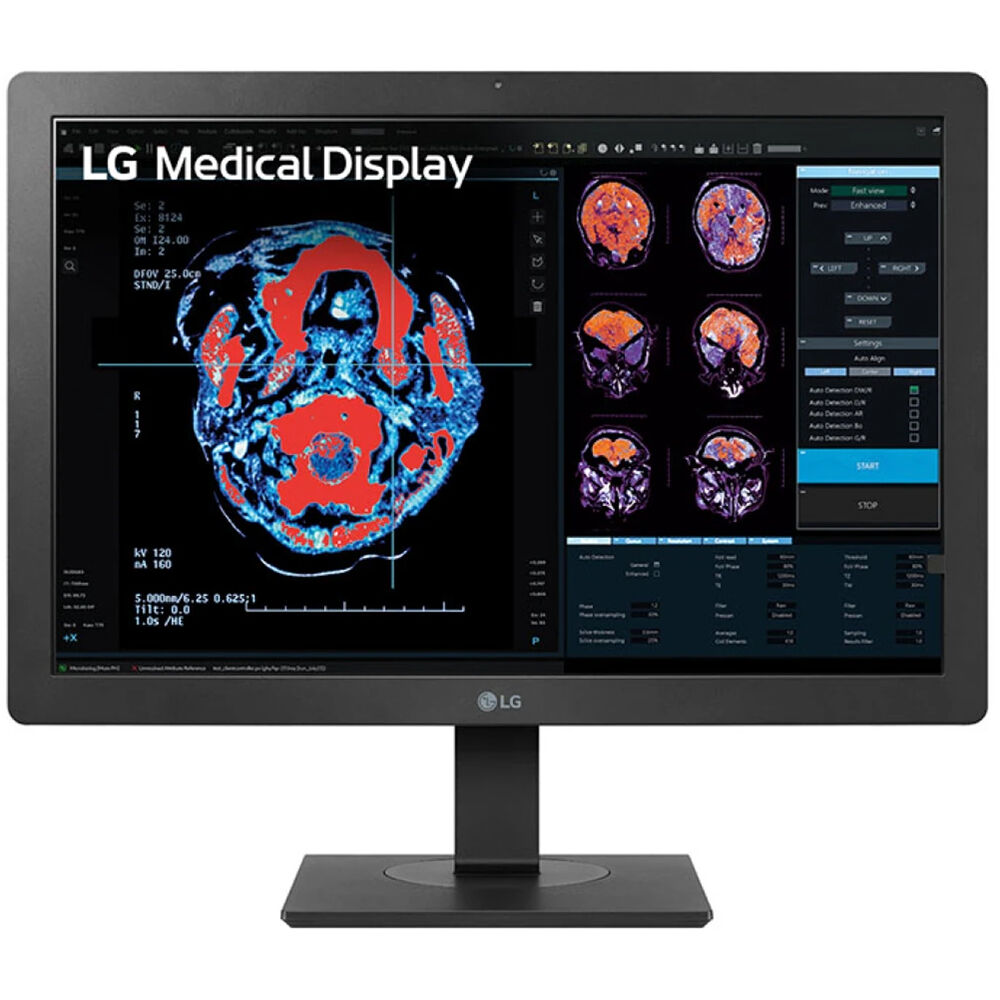 LG 24HR513C-B 24-inch 2MP diagnostic monitor with IPS panel and 2-way pivot — view 3