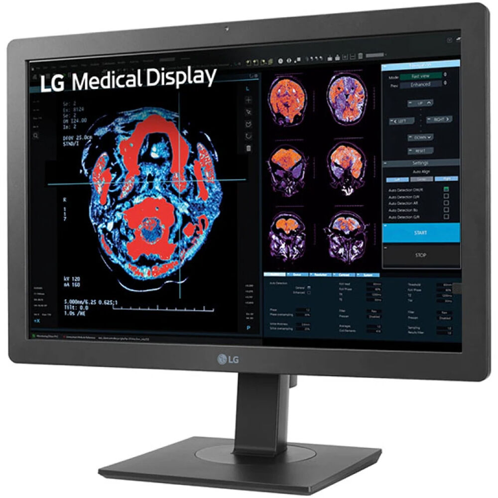 LG 24HR513C-B 24-inch 2MP diagnostic monitor with IPS panel and 2-way pivot — view 4