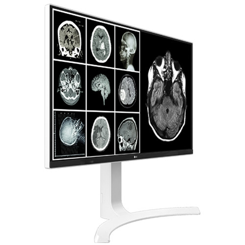 LG 27HJ713C-B 27-inch 4K IPS clinical monitor with HDMI and DisplayPort — view 2