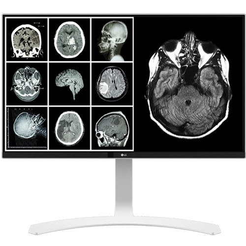 LG 27HJ713C-B 27-inch 4K IPS clinical monitor with HDMI and DisplayPort — view 3