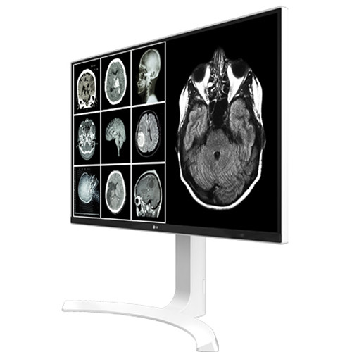 LG 27HJ713C-B 27-inch 4K IPS clinical monitor with HDMI and DisplayPort — view 8