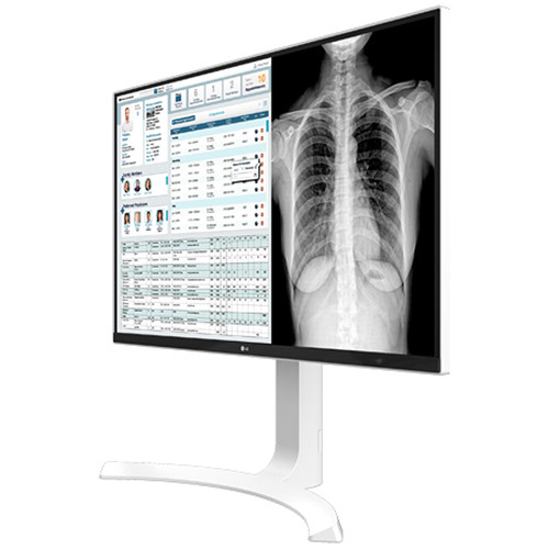 LG 27HJ713C-B 27-inch 4K IPS clinical monitor with HDMI and DisplayPort — view 9
