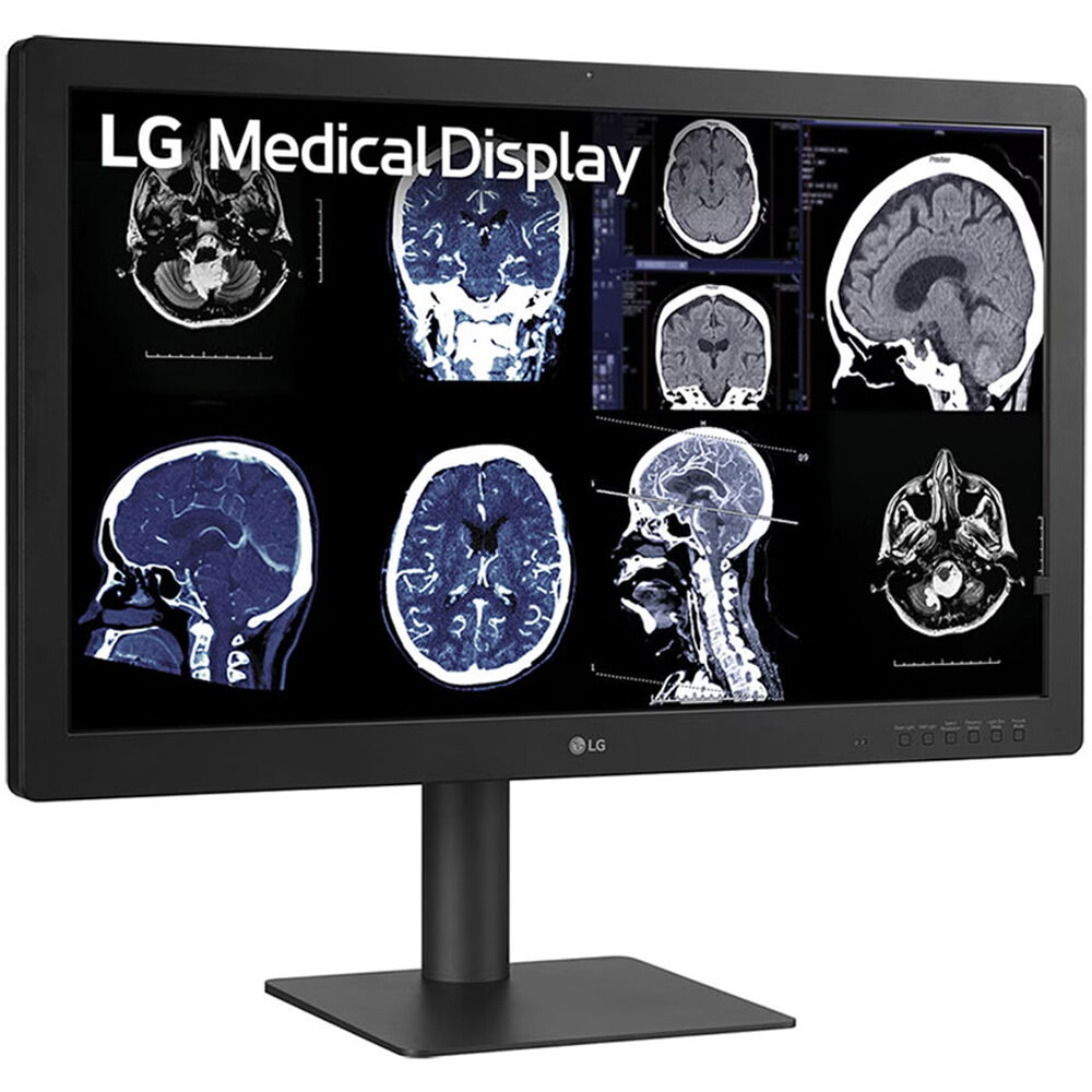 LG 32-inch IPS Black 8MP diagnostic monitor with 4K resolution and front sensor — view 2