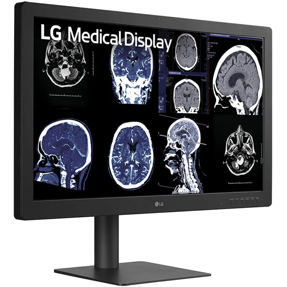 LG 32-inch IPS Black 8MP diagnostic monitor with 4K resolution and front sensor — view 3
