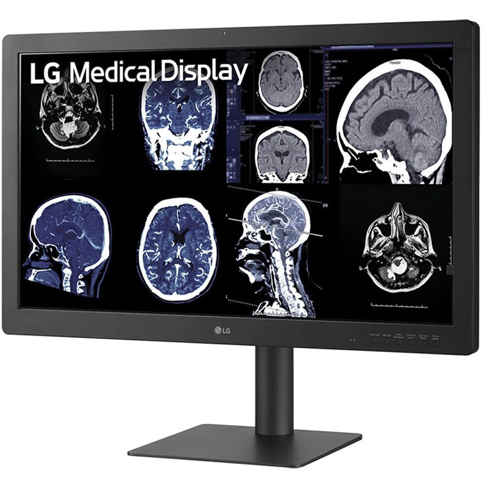 LG 32-inch IPS Black 8MP diagnostic monitor with 4K resolution and front sensor — view 4